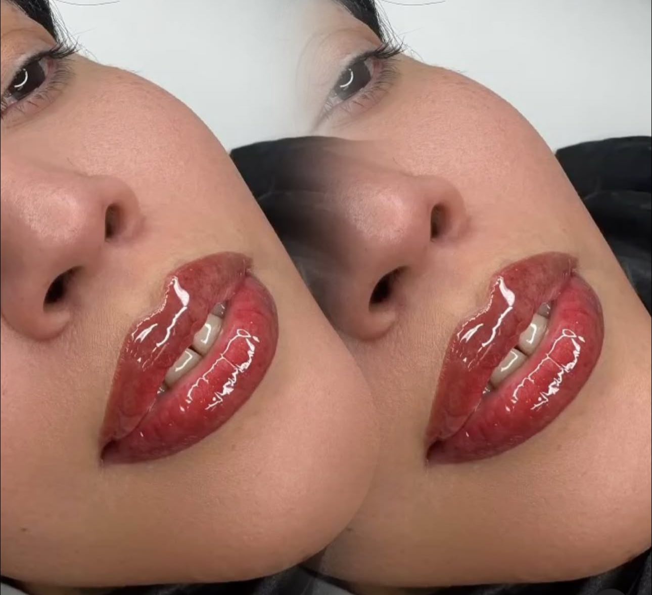 Labios
